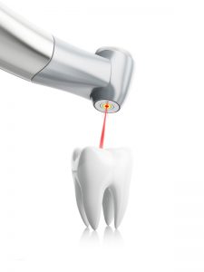 Zahnarzt Bellmann Langenhagen Laserbehandlung