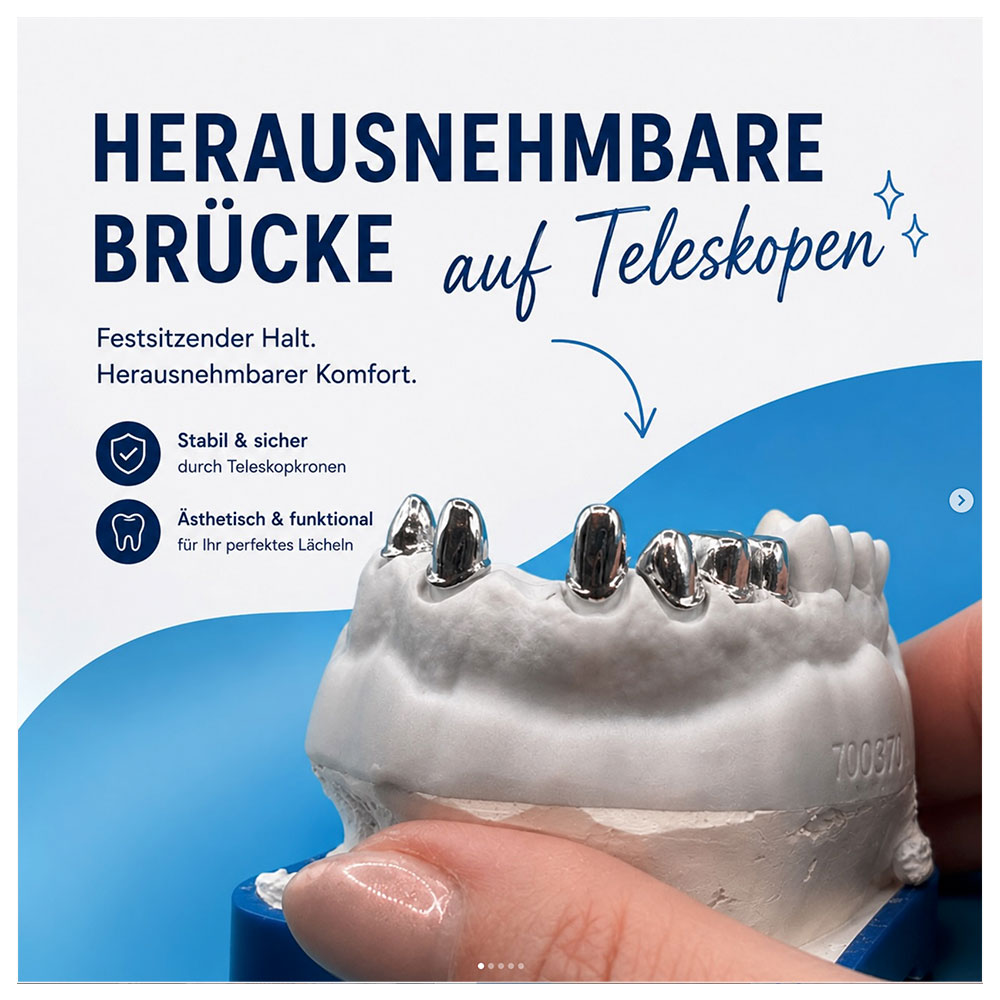 bruecke-auf-teleskop-01