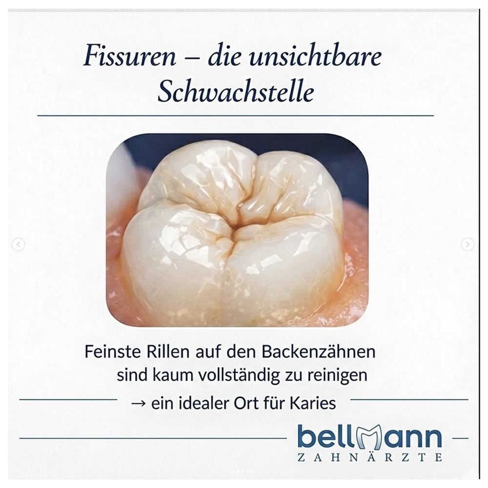 fissuren-info-02