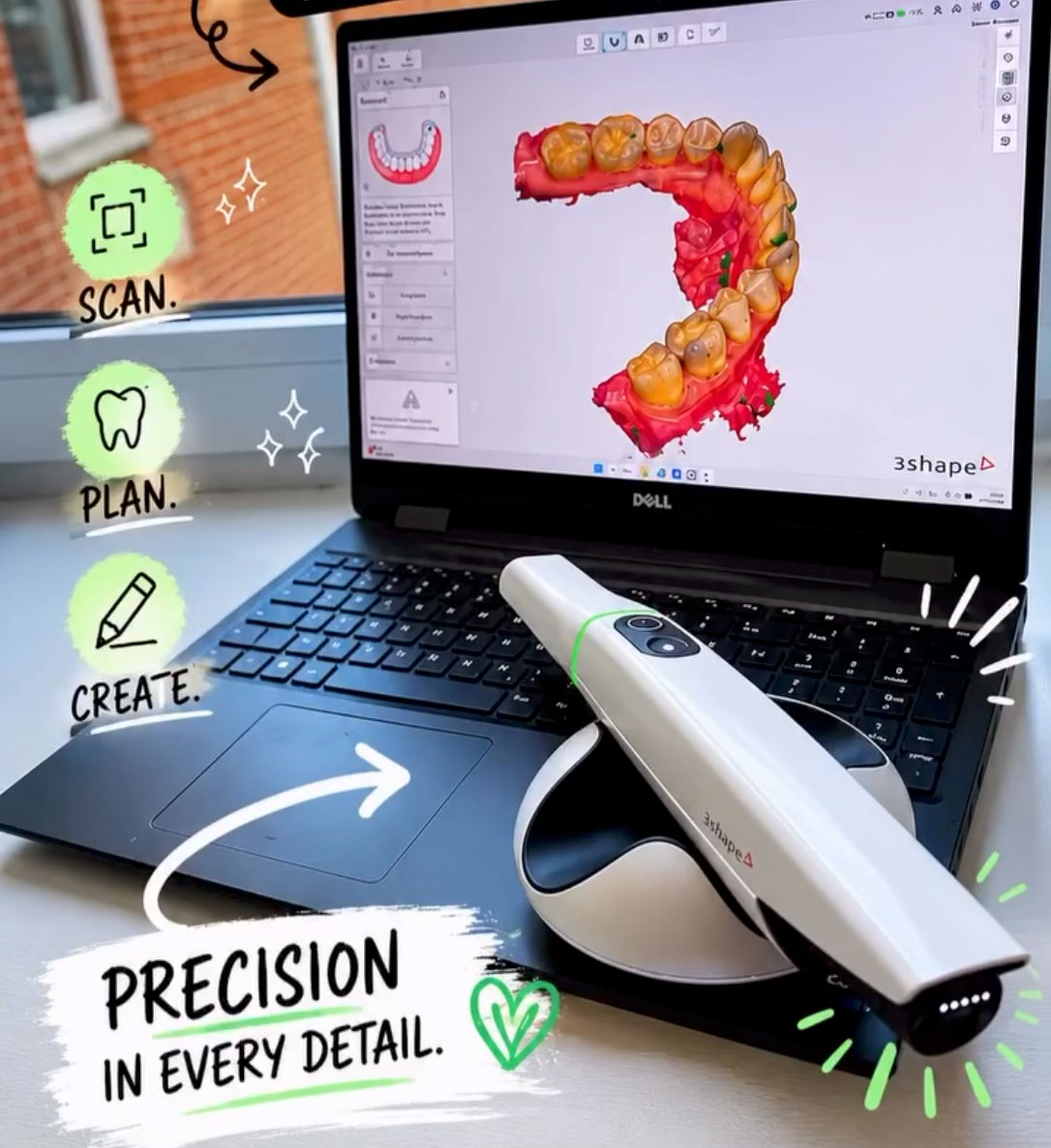 intraoralscanner