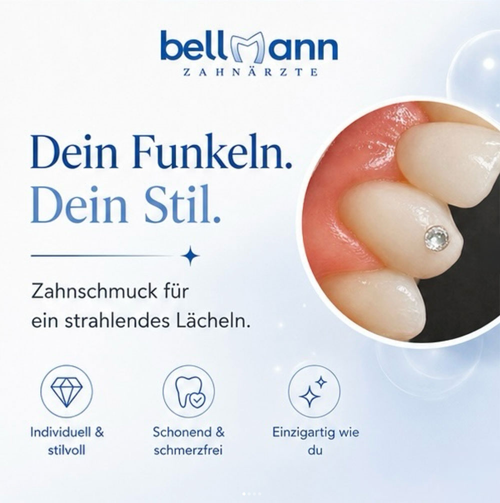 zahnschmuck-01
